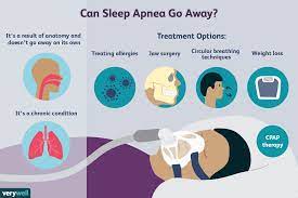 We did not find results for: Does Sleep Apnea Go Away Risk Factors And Prognosis