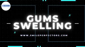 how to treat swollen gums at home