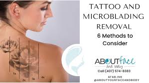 tattoo removal 6 methods to consider
