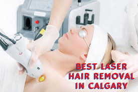 laser hair removal centres in calgary