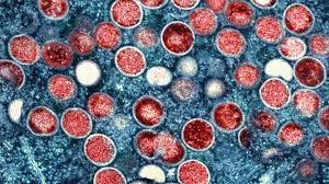 日本国内でサル痘の報告が急増 同じく増加している梅毒の皮疹とはどう違う？（忽那賢志） - エキスパート - Yahoo!ニュース