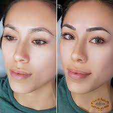 best eyebrow tattoo removal in new york