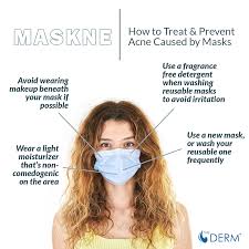 maskne how to avoid treat acne