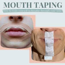 how to mouth tape family dental centre