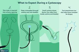 cystoscopy uses side effects