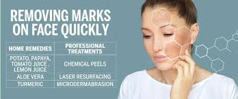 get rid of marks on face quickly with
