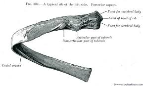 The first rib is the widest, shortest and has the sharpest curve of all the ribs. Typical Rib Posterior View Costal Rib Costal Groove