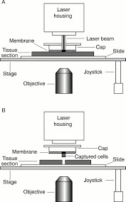 laser capture microdissection in