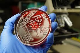 antibiotic resistant utis are common