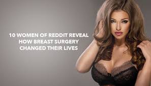 reddit reveal how t surgery