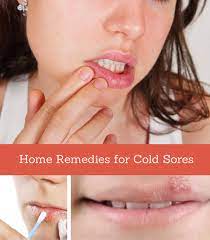 cold sores with nail polish remover