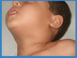 neck swelling treatment and surgery
