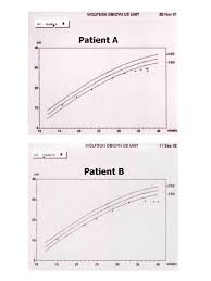 Head Circumference Growth Curves In 2 Fetuses With Suspected