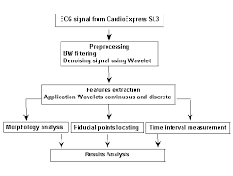 Process Flow Chart For Ecg Signal Features Extraction