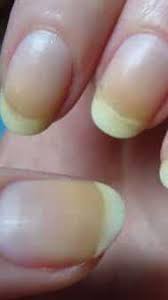 your nails can tell you about your health
