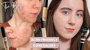 10 best concealers for acne scars for a