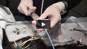 how to place a percutaneous pigtail