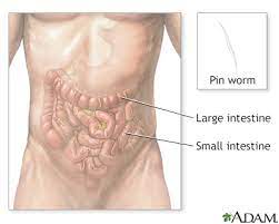 Pinworms Information Mount Sinai