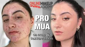 professional makeup artist look on acne
