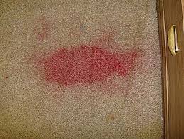 Make sure you blot without scrubbing; Ambassador Floor Company Cleaning Kool Aid Stains From Carpets