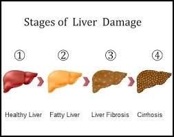 The scar tissue prevents the liver working properly. 18 Liver Facts For Kids Students And Teachers