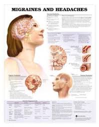 Migraines And Headaches Laminated Chart Lfa 99979