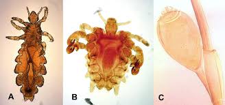 Laboratory Identification Of Arthropod Ectoparasites