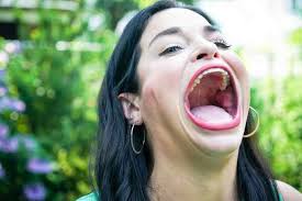 woman whose record breaking mouth gape