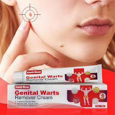 herpes wart remover ointment