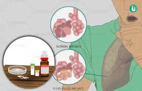 homeopathic treatment cines