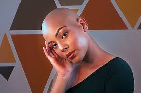 alopecia universalis causes ses