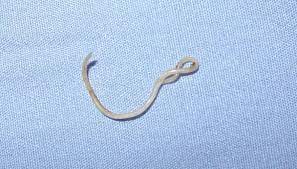 how do roundworms reproduce sciencing