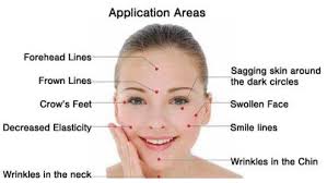 Image result for cosmetic acupuncture