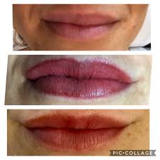 lip filler permanent lip color