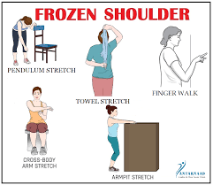 effective exercises for frozen shoulder