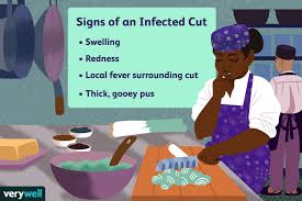 how to tell if a cut is infected