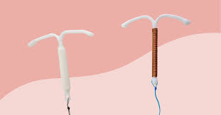 iud side effects and how to handle them