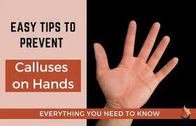 prevent calluses on your hands