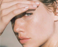 how to deal with melasma natural