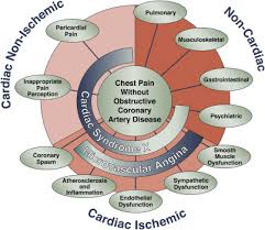 musculoskeletal chest pain an