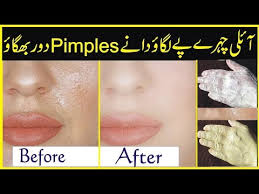 beauty tips in urdu naz skincare