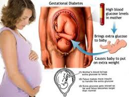 Selain itu, ibu hamil cenderung mengalami buasir dan juga sembelit atas faktor perubahan hormon yang berlaku dalam badan. Buasir Ketika Hamil Fizah Abdul Halim