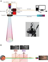 efficacy of novel multispectral imaging