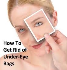 how to get rid of under eye bags dr