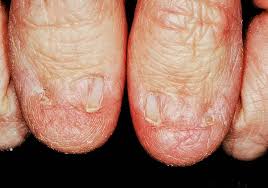 toenail problems symptoms causes and