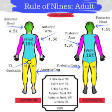Rule Of Nines For Ems Emt Training Base