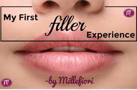 my first filler experience new lips