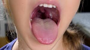inside mouth images browse 202 708