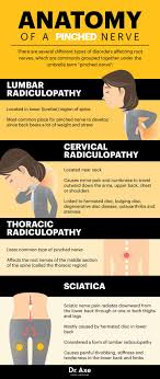 pinched nerve symptoms locations
