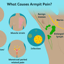 armpit pain causes treatment when to